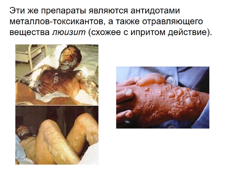 Эти же препараты являются антидотами металлов-токсикантов, а также отравляющего вещества люизит (схожее с ипритом